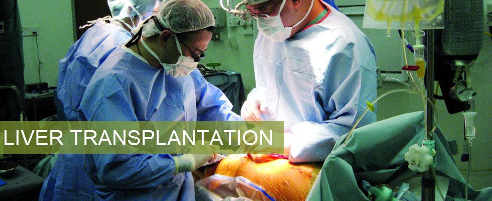 Liver Transplantation